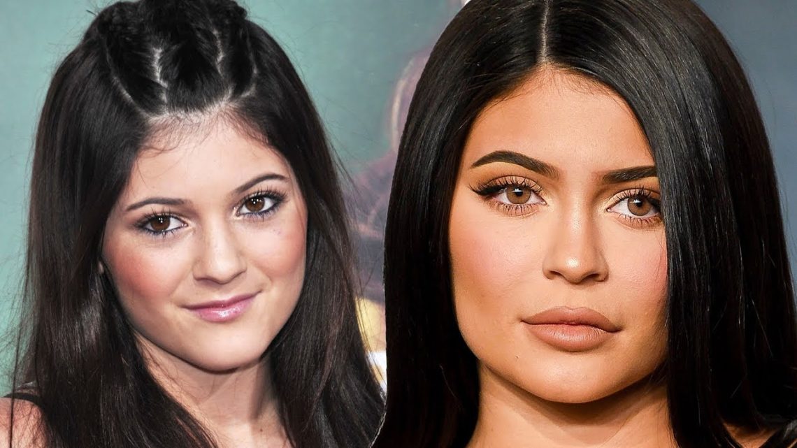 Kylie Jenner Transformation Over The Years